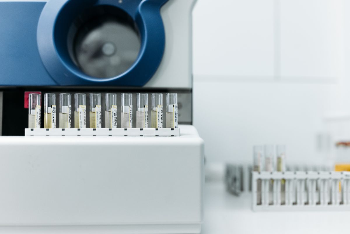 Racks of sample test tubes beside a laboratory analyzer